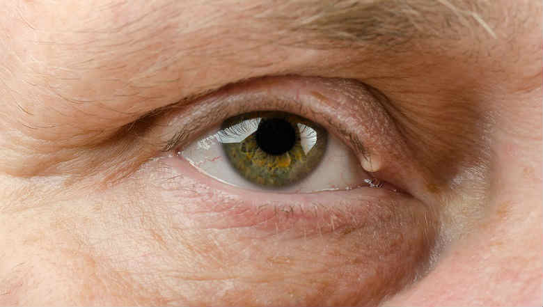 Глазная пластическая хирургия