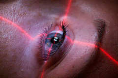 Лазерное лечение глаукомы глаза в Наро-Фоминске