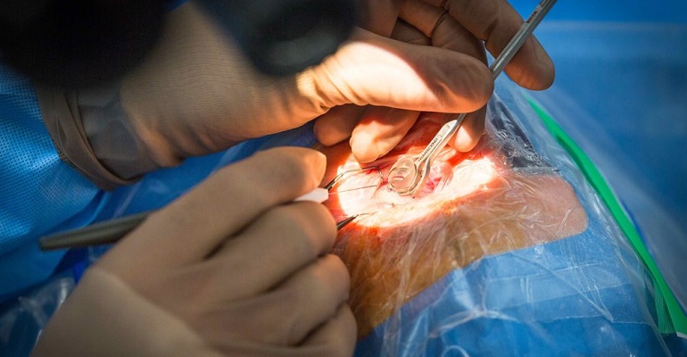 Цена хирургического лечения глаукомы в Наро-Фоминске
