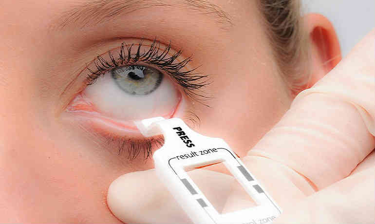 Диагностика синдрома сухого глаза