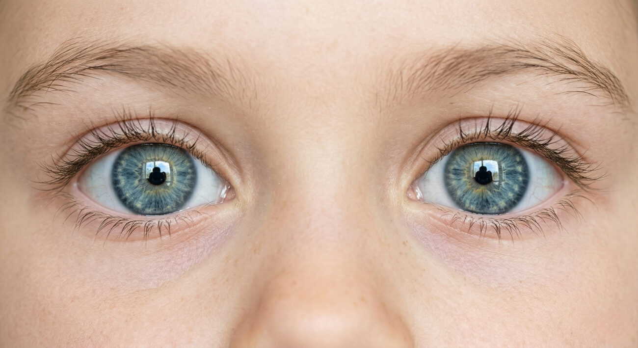 Крупный план здоровых детских глаз после успешного лечения халязиона в нашей офтальмологической клинике.